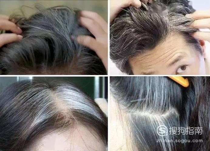染了黑发怎么漂