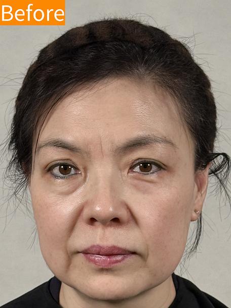 女人看哪看出真实年龄
