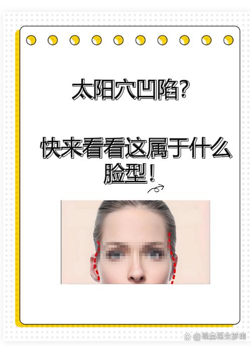 女生太阳凹陷的面相